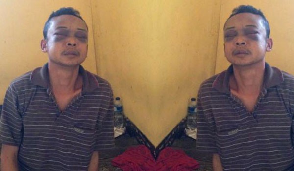 Tersangka Heriyanto babak belur dihajar masa